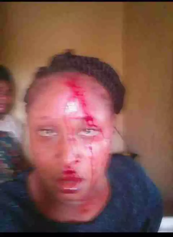 See What A Man Did To His Wife After Accusing Her Of Cheating (Photos)